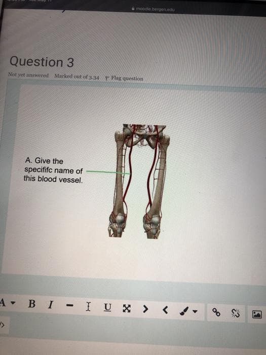 a moodle bergen.edu
Question 3
Not yet answered Marked out of 3-34 P Flag question
A. Give the
specififc name of
this blood vessel.
BI-I UX >
