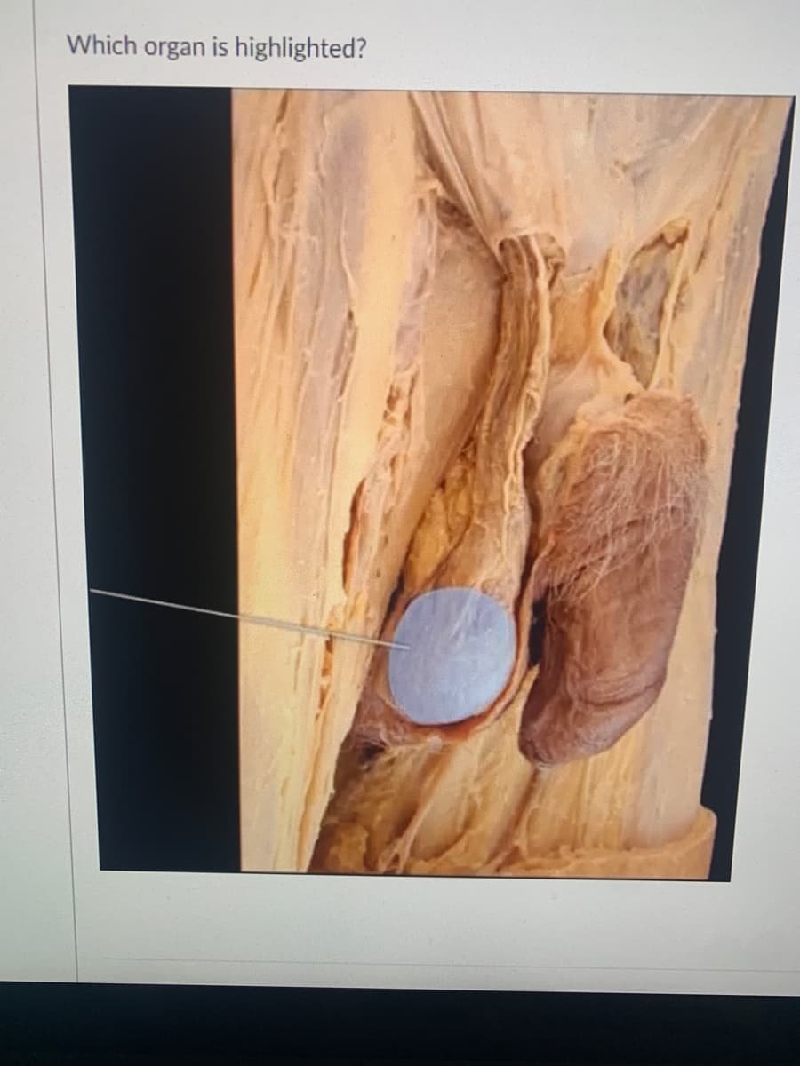 Which organ is highlighted?
