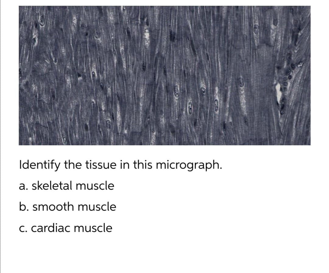 Identify the tissue in this micrograph.
a. skeletal muscle
b. smooth muscle
c. cardiac muscle