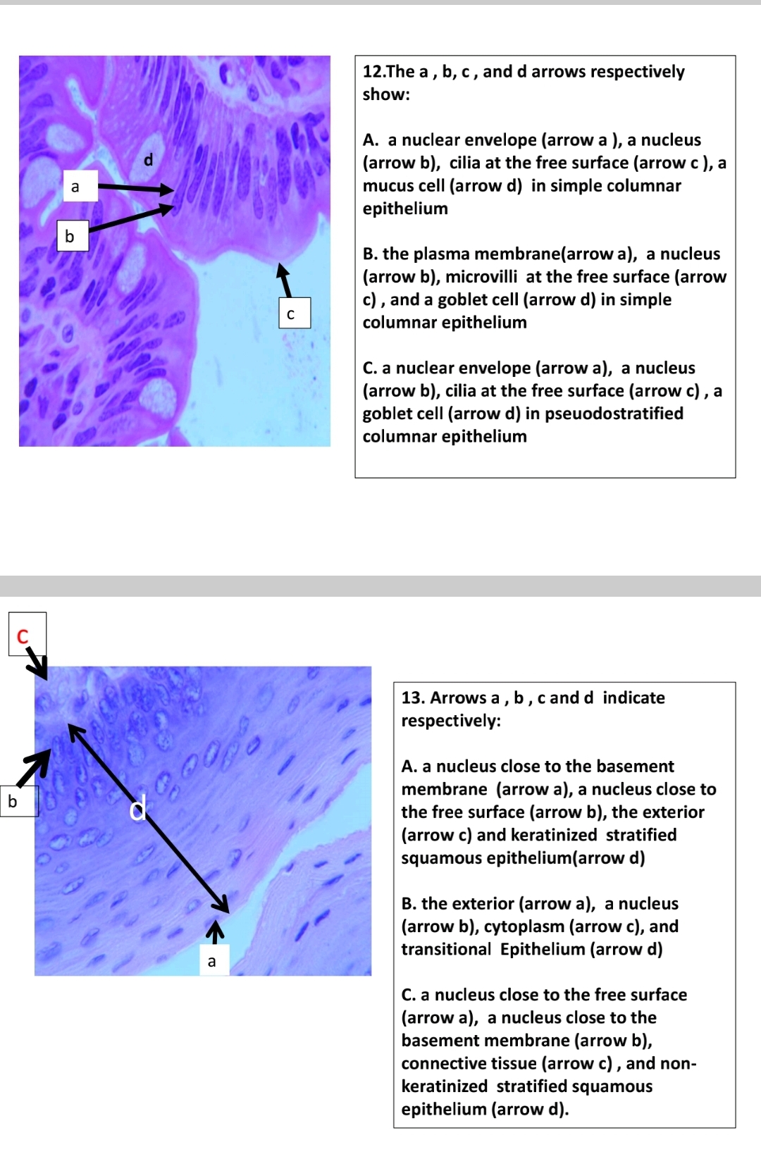 12.The a , b, c , and d arrows respectively
show:
A. a nuclear envelope (arrow a ), a nucleus
(arrow b), cilia at the free surface (arrow c ), a
mucus cell (arrow d) in simple columnar
epithelium
d.
a
b
B. the plasma membrane(arrow a), a nucleus
(arrow b), microvilli at the free surface (arrow
c) , and a goblet cell (arrow d) in simple
columnar epithelium
C. a nuclear envelope (arrow a), a nucleus
(arrow b), cilia at the free surface (arrow c) , a
goblet cell (arrow d) in pseuodostratified
columnar epithelium
13. Arrows a , b,c and d indicate
respectively:
A. a nucleus close to the basement
membrane (arrow a), a nucleus close to
the free surface (arrow b), the exterior
(arrow c) and keratinized stratified
squamous epithelium(arrow d)
B. the exterior (arrow a), a nucleus
(arrow b), cytoplasm (arrow c), and
transitional Epithelium (arrow d)
a
C. a nucleus close to the free surface
(arrow a), a nucleus close to the
basement membrane (arrow b),
connective tissue (arrow c) , and non-
keratinized stratified squamous
epithelium (arrow d).
