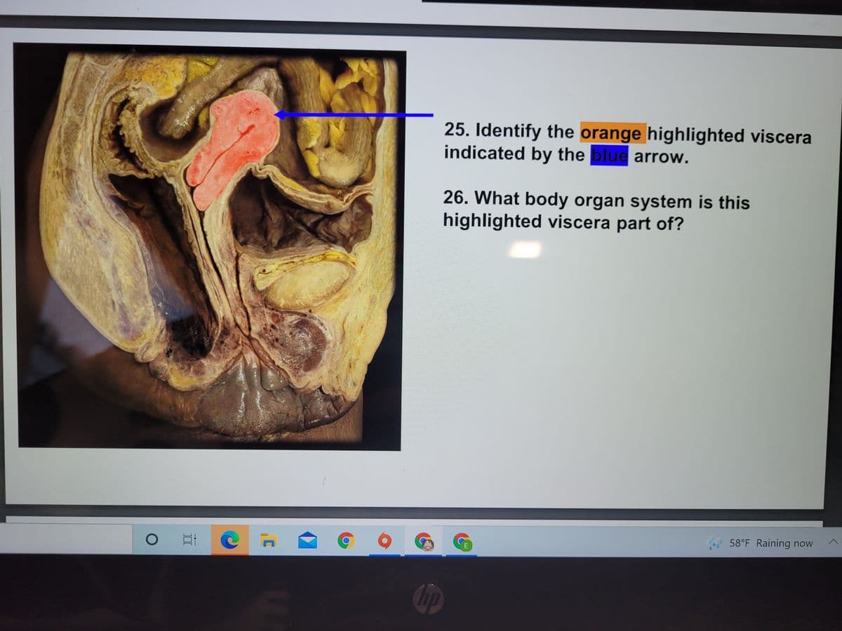 25. Identify the orange highlighted viscera
indicated by the blue arrow.
26. What body organ system is this
highlighted viscera part of?
58°F Raining now
hp
