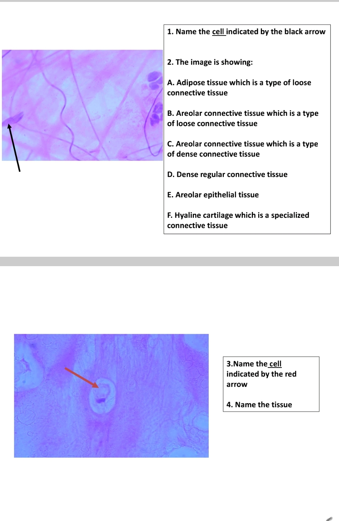 1. Name the cell indicated by the black arrow
2. The image is showing:
A. Adipose tissue which is a type of loose
connective tissue
B. Areolar connective tissue which is a type
of loose connective tissue
C. Areolar connective tissue which is a type
of dense connective tissue
D. Dense regular connective tissue
E. Areolar epithelial tissue
F. Hyaline cartilage which is a specialized
connective tissue
3.Name the cell
indicated by the red
arrow
4. Name the tissue
