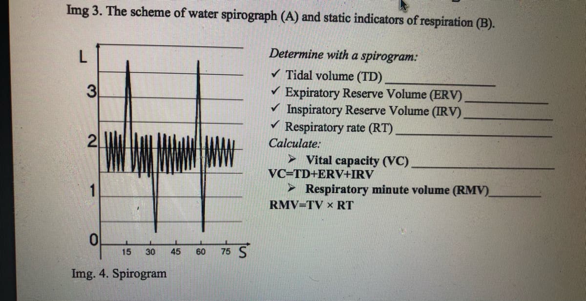 Img 3. The scheme of water spirograph (A) and static indicators of respiration (B).
Determine with a spirogram:
Tidal volume (TD),
V Expiratory Reserve Volume (ERV)
v Inspiratory Reserve Volume (IRV)
Respiratory rate (RT)
Calculate:
3
WAWY
2
> Vital capacity (VC)
VC=TD+ERV+IRV
1
Respiratory minute volume (RMV)
RMV=TV × RT
75 S
15
30
45
60
Img. 4. Spirogram
