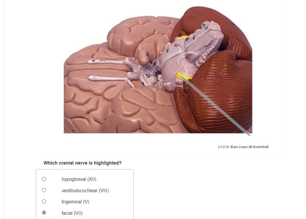 Which cranial nerve is highlighted?
hypoglossal (XII)
vestibulocochlear (VIII)
trigeminal (V)
facial (VII)
LT-C15: Brain 2-part 38 Scientific