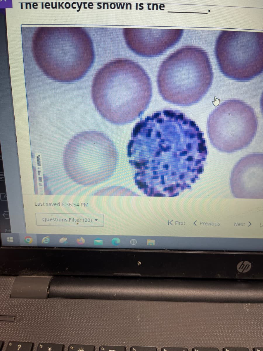 The image on this page demonstrates a microscopic view of blood cells. Included in the image are multiple red blood cells, which appear as round, pinkish discs, and one prominent leukocyte (white blood cell) that stands out with a darker, more textured appearance.

**Description of Blood Cells:**
1. **Red Blood Cells (RBCs):** These cells are numerous in the image and manifest as uniformly round cells with a pinkish hue. They lack a nucleus and appear relatively homogenous in size.

2. **Leukocyte:** The central focus of the image is a single, distinctly darker cell surrounded by the red blood cells. This leukocyte appears significantly textured and its color varies from shades of blue to purple, indicating the presence of a nucleus with granular components.

**Educational Context:**
This image can be used to help students identify the different types of cells present in a blood smear. The red blood cells are responsible for oxygen transport, while leukocytes play a crucial role in the immune system by defending the body against infections. 

**Quiz Question Context:**
The incomplete sentence at the top of the image, "The leukocyte shown is the _______," suggests a fill-in-the-blank question, likely asking students to identify the specific type of leukocyte (e.g., neutrophil, eosinophil, basophil, lymphocyte, or monocyte). 

Understanding the structure and function of these cells is fundamental in studies of hematology, immunology, and general biology. 

**Graph/Diagram Explanation:**
There is no complex graph or diagram to detail in this image, but the high-resolution microscopy provides a clear visual of cell morphology crucial for learning. The colors and visibility of the cell structures are essential for differentiating between types of blood cells, making it a valuable educational tool.