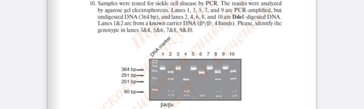 10. Samples were tested for sickle cell disease by PCR. The results were analyzed
by agarosc gel electrophoresis. Lanes I, 3, 5, 7, and 9 are PCR-amplified, but
undigested DNA (364 bp), and lanes 2, 4, 6, 8, and 10 are Ddel-digested DNA.
Lanes 1&2 are from a known carrier DNA (B^/B", 4 bands). Please, identify the
genotype in lanes 3&4, 5&6, 7&8, 9&10.
DNA marker
1 2 3 4 5 6 7 8
uents
10
364 bp-
291 bp-
201 bp-
bp
CKO
BA/Bs
