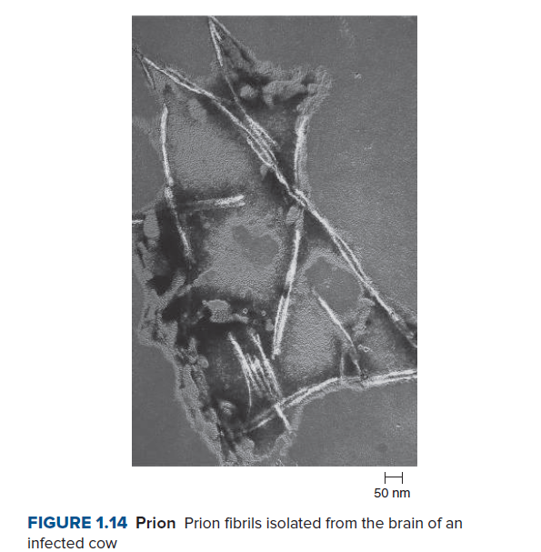 50 nm
FIGURE 1.14 Prion Prion fibrils isolated from the brain of an
infected cow
