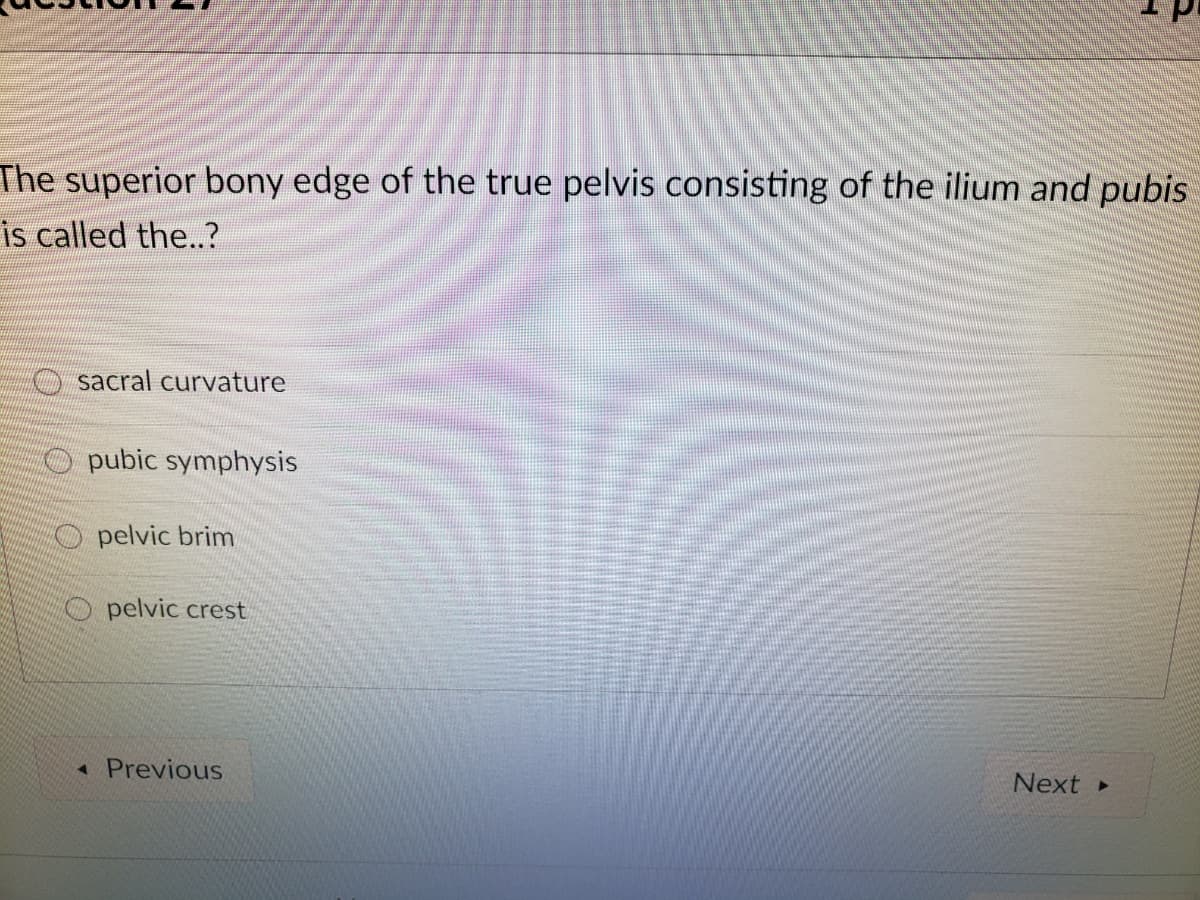 The superior bony edge of the true pelvis consisting of the ilium and pubis
is called the..?
O sacral curvature
O pubic symphysis
pelvic brim
O pelvic crest
* Previous
Next
