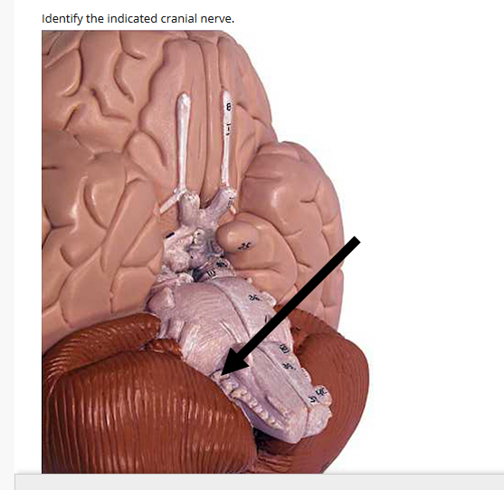 Identify the indicated cranial nerve.
