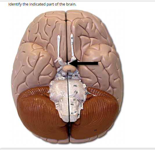 Identify the indicated part of the brain.
