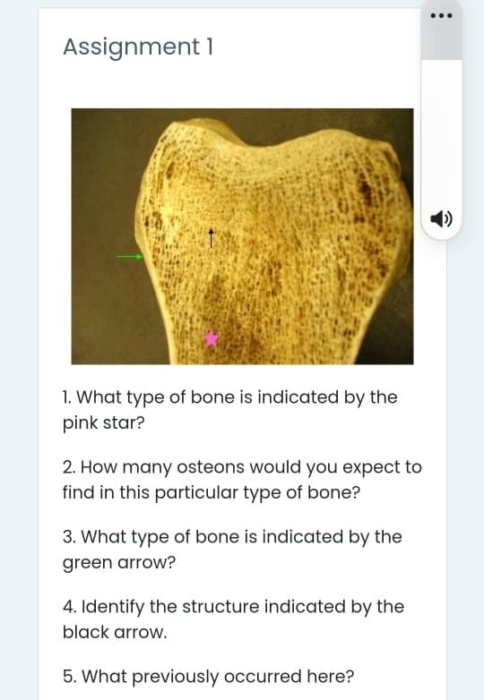 Assignment 1
1. What type of bone is indicated by the
pink star?
2. How many osteons would you expect to
find in this particular type of bone?
3. What type of bone is indicated by the
green arrow?
4. Identify the structure indicated by the
black arrow.
5. What previously occurred here?
