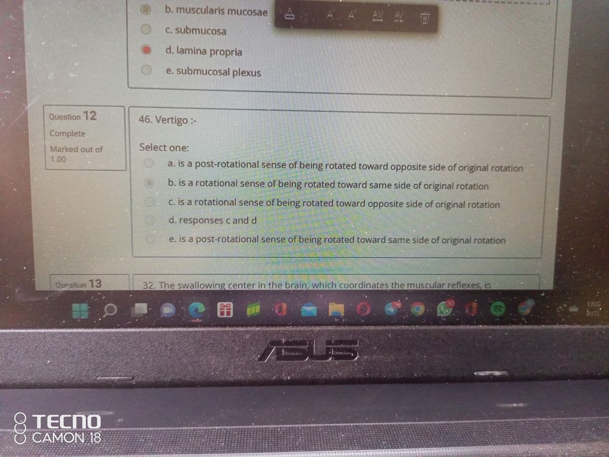 Question 12
Complete
Marked out of
Question 13
TECNO
CAMON 18
b. muscularis mucosae
A AV T
A
c. submucosa
d. lamina propria
e. submucosal plexus
46. Vertigo :-
Select one:
a. is a post-rotational sense of being rotated toward opposite side of original rotation
b. is a rotational sense of being rotated toward same side of original rotation
c. is a rotational sense of being rotated toward opposite side of original rotation
d. responses c and d
e. is a post-rotational sense of being rotated toward same side of original rotation
32. The swallowing center in the brain, which coordinates the muscular reflexes, is
بنات
}}}
ENG
INTE