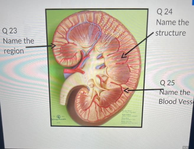 Q23
Name the
region
Copy
GOREN
260
Ma
Q24
Name the
structure
Q25
Name the
Blood Vess