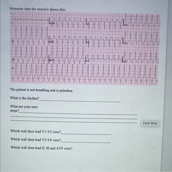 Moments later the monitor shows this:
VR
aVF
The patient is not breathing and is pulseless.
What is the rhythm?
What are your next
steps?
Font Size
Which wall does lead V1-V2 view?
Which wall does lead V3-V4 view?
Which wall does lead II, III and AVF view?
