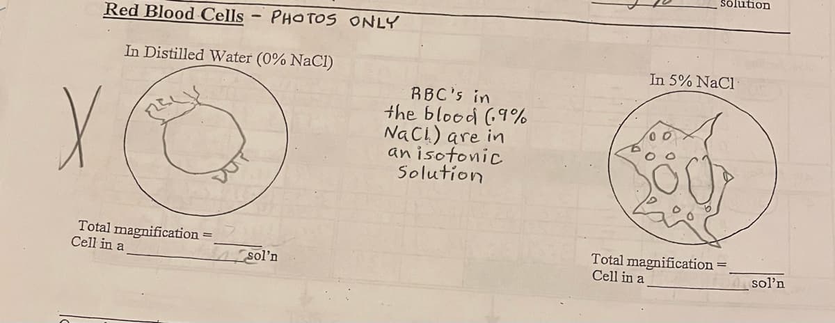 solution
Red Blood Cells - PHOTOS ONLY
In Distilled Water (0% NaCl)
In 5% NaCl
RBC's in
the blood (9%
NaCL) are in
an isotonic
Solution
Total magnification
Cell in a
Total magnification
Cell in a
sol'n
sol'n
