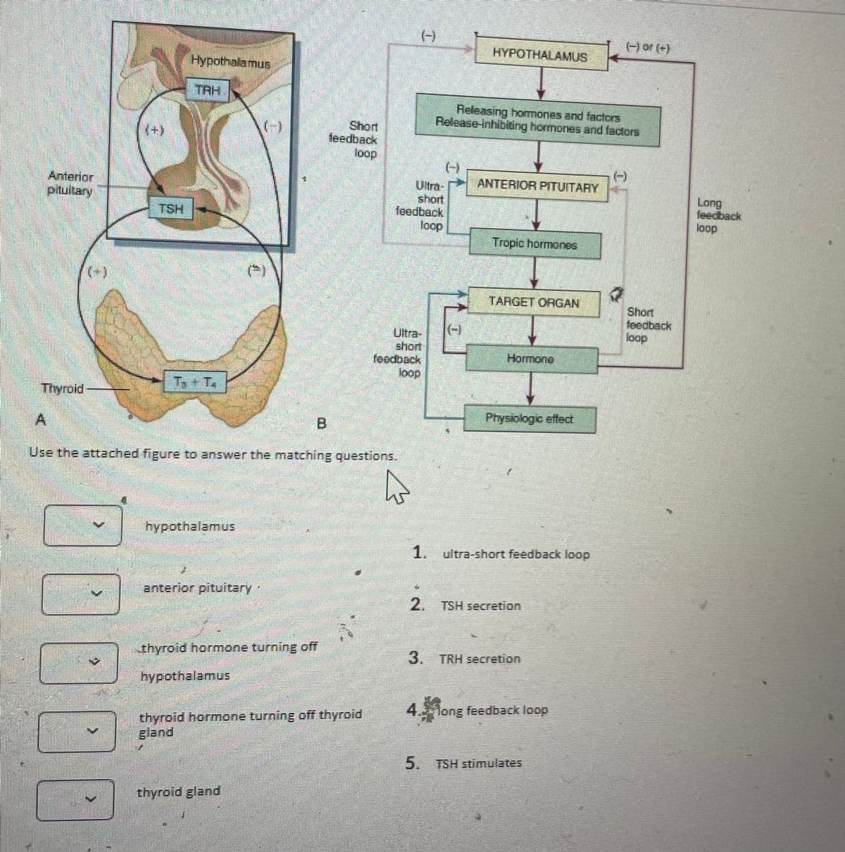 Anterior
pituitary
Thyroid
A
C
(+)
00
TSH
Hypothalamus
TAH
T. + T
hypothalamus
()
| anterior pituitary
Use the attached figure to answer the matching questions.
hypothalamus
B
thyroid hormone turning off
thyroid gland
Short
feedback
loop
thyroid hormone turning off thyroid
gland
(-)
short
feedback
short
foodback
4
HYPOTHALAMUS
2.
Releasing hormones and factors
Release-inhibiting hormones and factors
ANTERIOR PITUITARY
Tropic hormones
TARGET ORGAN
Hormone
1. ultra-short feedback loop
Physiologic effect
TSH secretion
3. TRH secretion
4.-long feedback loop
(-) or (+)
5. TSH stimulates
(-)
Short
feedback
loop
Long
feedback
loop