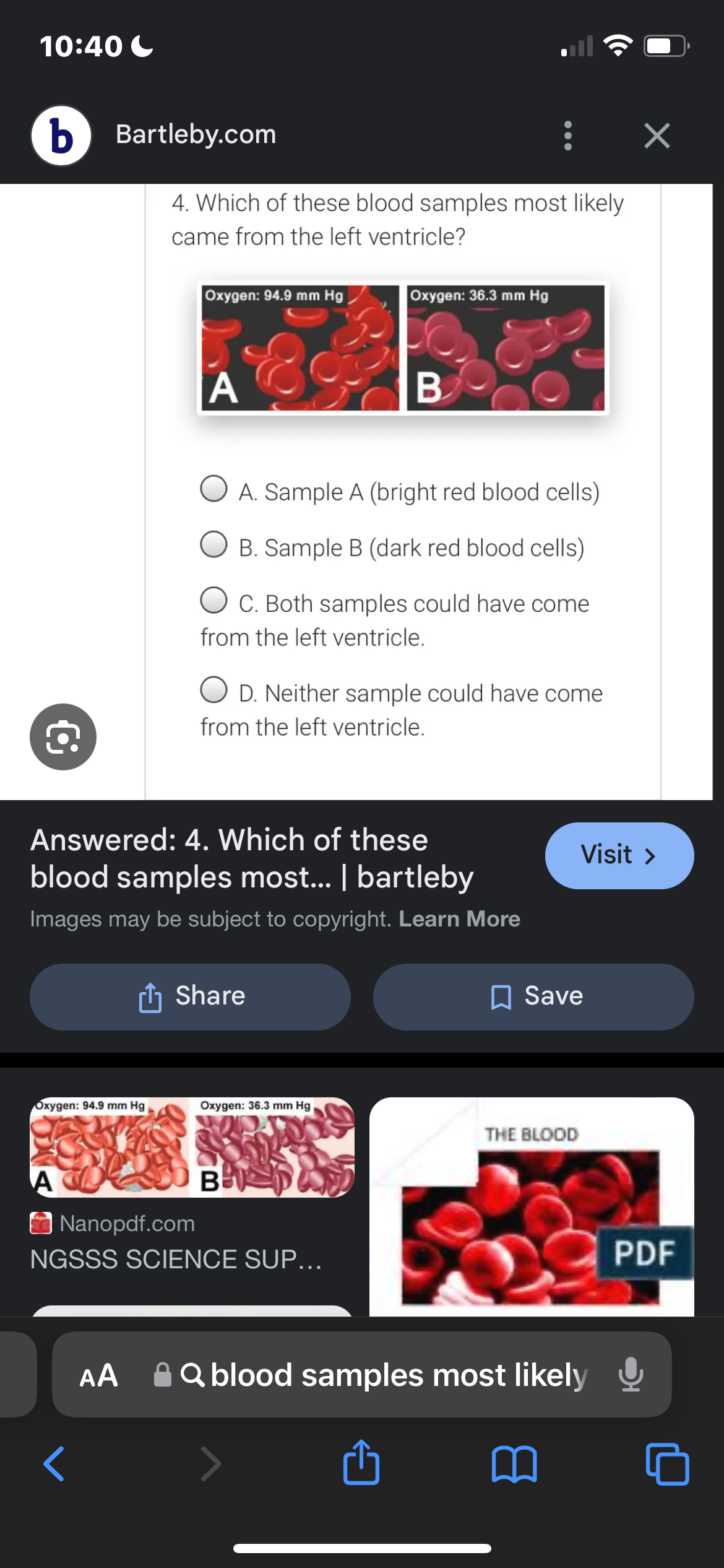 10:40-
b Bartleby.com
4. Which of these blood samples most likely
came from the left ventricle?
Oxygen: 94.9 mm Hg
Oxygen: 36.3 mm Hg
A
B
A. Sample A (bright red blood cells)
B. Sample B (dark red blood cells)
C. Both samples could have come
from the left ventricle.
○ D. Neither sample could have come
from the left ventricle.
Answered: 4. Which of these
blood samples most... | bartleby
Images may be subject to copyright. Learn More
Share
☐ Save
Oxygen: 94.9 mm Hg
Oxygen: 36.3 mm Hg
THE BLOOD
A
Nanopdf.com
B
NGSSS SCIENCE SUP...
☑
Visit >
PDF
AA
⚫ Q blood samples most likely ↓