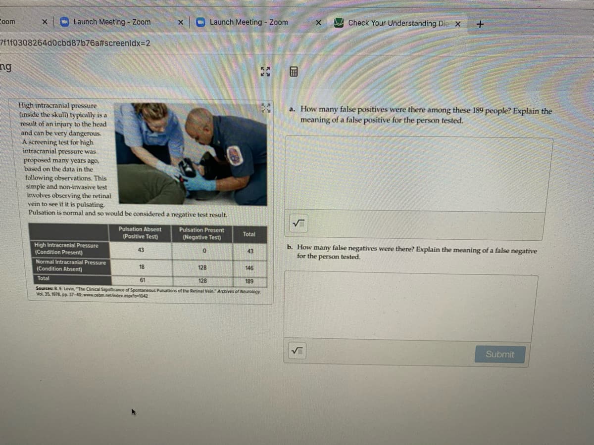 Coom
O Launch Meeting Zoom
O Launch Meeting Zoom
Check Your Understanding Die x
711f0308264d0cbd87b76a#screenldx=D2
ng
High intracranial pressure
(inside the skull) typically is a
a. How many false positives were there among these 189 people? Explain the
meaning of a false positive for the person tested.
result of an injury to the head
and can be very dangerous.
A screening test for high
intracranial pressure was
proposed many years ago,
based on the data in the
following observations. This
simple and non-invasive test
involves observing the retinal
vein to see if it is pulsating.
Pulsation is normal and so would be considered a negative test result.
Pulsation Absent
Pulsation Present
Total
(Positive Test)
(Negative Test)
High Intracranial Pressure
(Condition Present)
Normal Intracranial Pressure
b. How many false negatives were there? Explain the meaning of a false negative
for the person tested.
43
43
(Condition Absent)
18
128
146
Total
61
128
189
Sources: B.E Levin, "The Clinical Significance of Spontaneous Pulsations of the Retinal Vein." Archives of Neurology.
Vol. 35. 1978. pp. 37-40: www.cebm.net/index.esplo-1042
Submit
