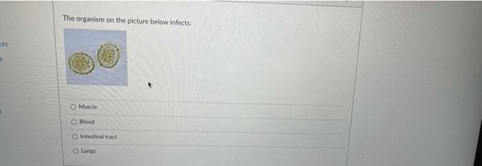 The organism on the picture below infects:
Ces
O Muscle
O Blood
O Intestinal tract
O Lungs
