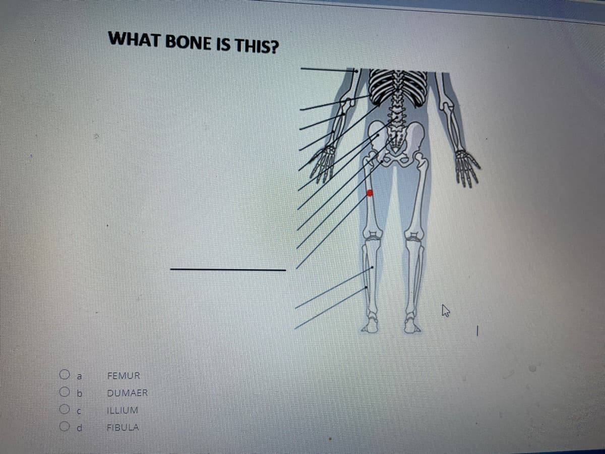 WHAT BONE IS THIS?
al
FEMUR
DUMAER
ILLIUM
d.
FIBULA
OO O O
