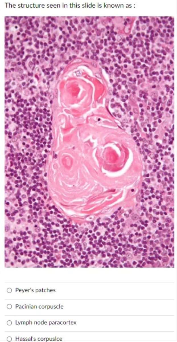 The structure seen in this slide is known as:
O Peyer's patches
O Pacinian corpuscle
O Lymph node paracortex
O Hassal's corpuslce