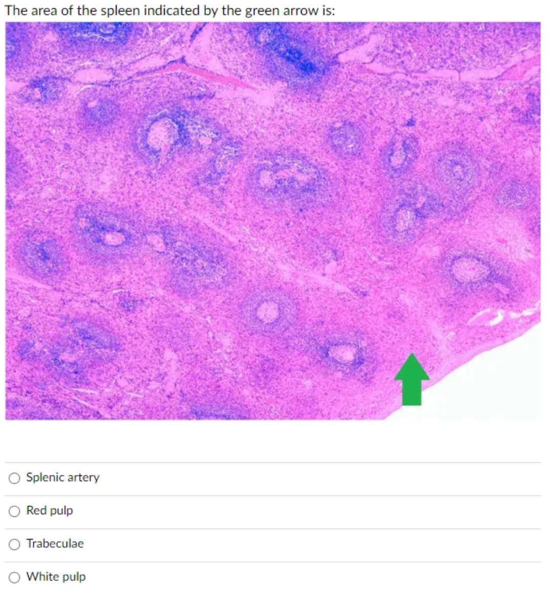 The area of the spleen indicated by the green arrow is:
Splenic artery
Red pulp
Trabeculae
White pulp