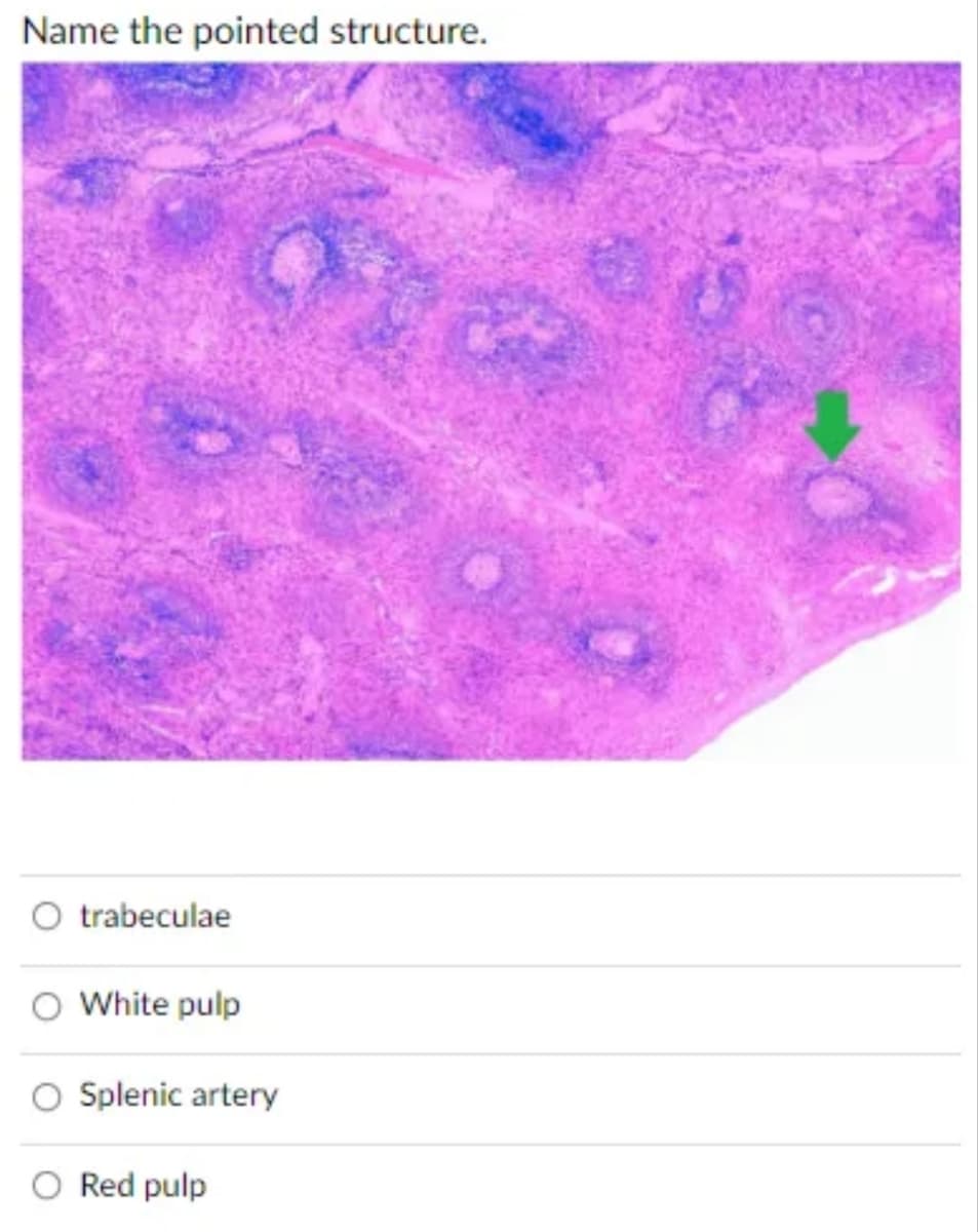 Name the pointed structure.
O trabeculae
O White pulp
Splenic artery
Red pulp