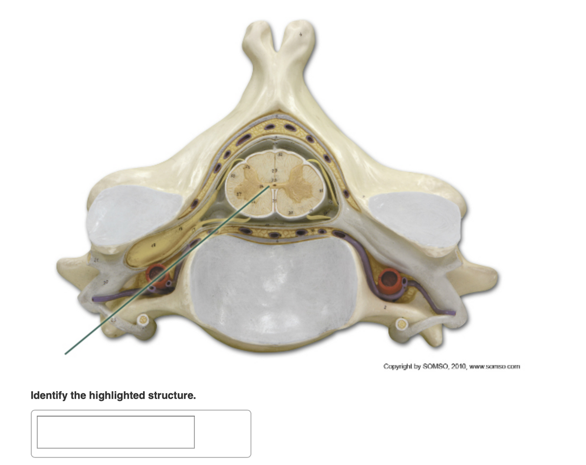 Coxıyrighl bry SOMSO, 2010, www STISD Com
Identify the highlighted structure.
