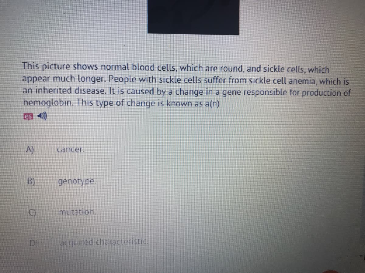 This picture shows normal blood cells, which are round, and sickle cells, which
appear much longer. People with sickle cells suffer from sickle cell anemia, which is
an inherited disease. It is caused by a change in a gene responsible for production of
hemoglobin. This type of change is known as a(n)
es 41)
A)
cancer.
B)
genotype.
mutation.
D)
acquired characteristic.
