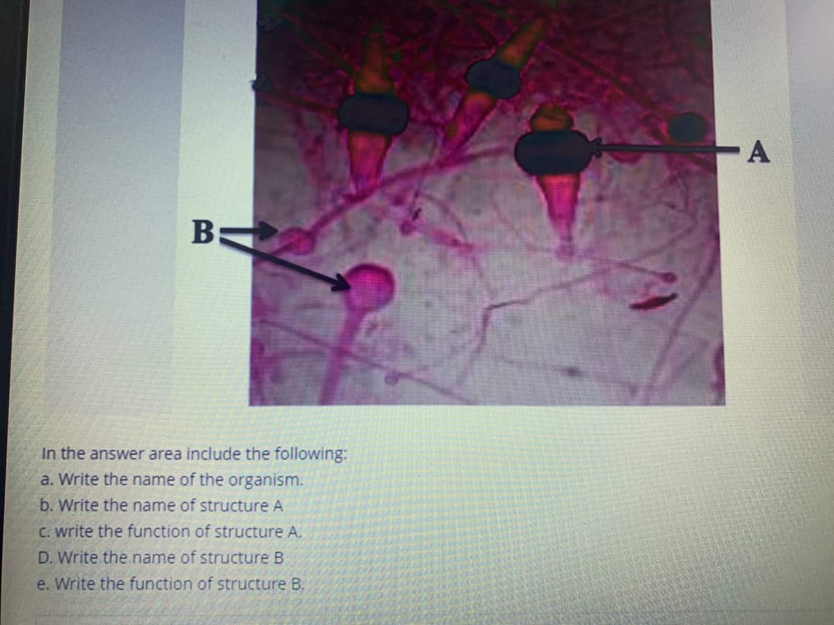 A
B
In the answer area include the following:
a. Write the name of the organism.
b. Write the name of structure A
C. write the function of structure A.
D. Write the name of structure B
e. Write the function of structure B.
