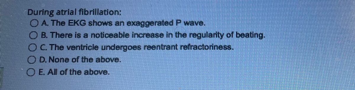 During atrial fibrillation:
A. The EKG shows an exaggerated P wave.
B. There is a noticeable increase in the regularity of beating.
OC. The ventricle undergoes reentrant refractoriness.
OD. None of the above.
OE. All of the above.