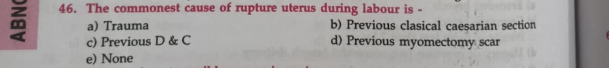 ABNC
46. The commonest cause of rupture uterus during labour is -
a) Trauma
c) Previous D & C
e) None
b) Previous clasical caesarian section
d) Previous myomectomy scar
E