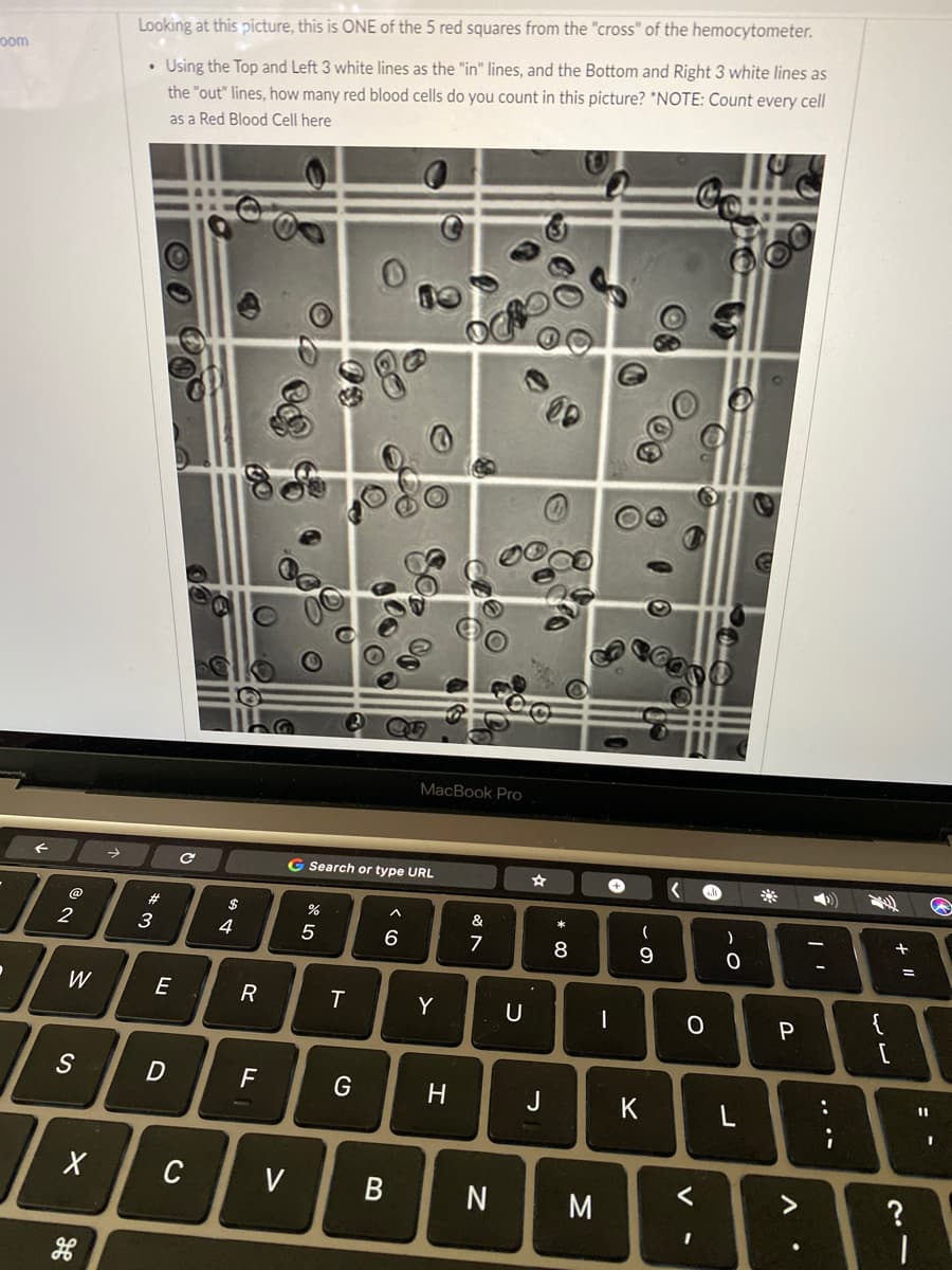 Looking at this picture, this is ONE of the 5 red squares from the "cross" of the hemocytometer.
• Using the Top and Left 3 white lines as the "in" lines, and the Bottom and Right 3 white lines as
the "out" lines, how many red blood cells do you count in this picture? *NOTE: Count every cell
oom
as a Red Blood Cell here
MacBook Pro
G Search or type URL
186
@
2$
&
*
2
3
4
7
8
W
E
T
Y
U
一
S
H
J
K
L
C
V
N
M
.. ..
B
