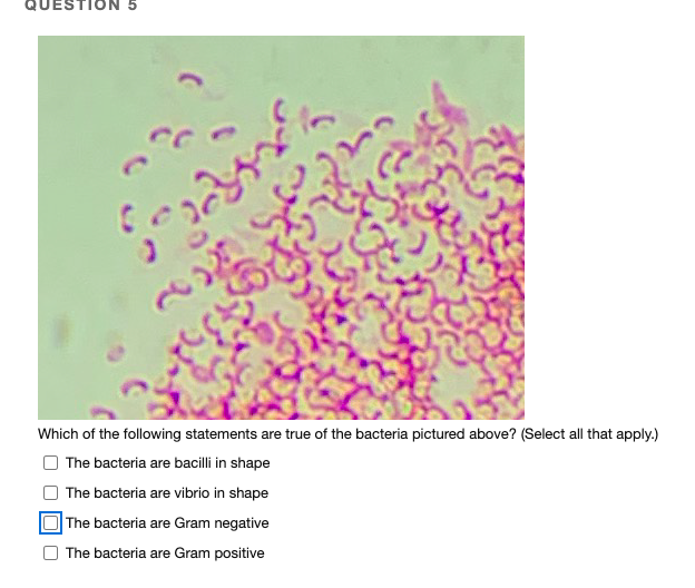 QUESTION 5
Which of the following statements are true of the bacteria pictured above? (Select all that apply.)
The bacteria are bacilli in shape
The bacteria are vibrio in shape
The bacteria are Gram negative
The bacteria are Gram positive
