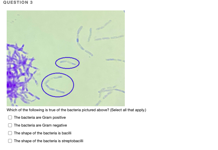 QUESTION 3
Which of the following is true of the bacteria pictured above? (Select all that apply.)
| The bacteria are Gram positive
The bacteria are Gram negative
The shape of the bacteria is bacilli
The shape of the bacteria is streptobacilli
