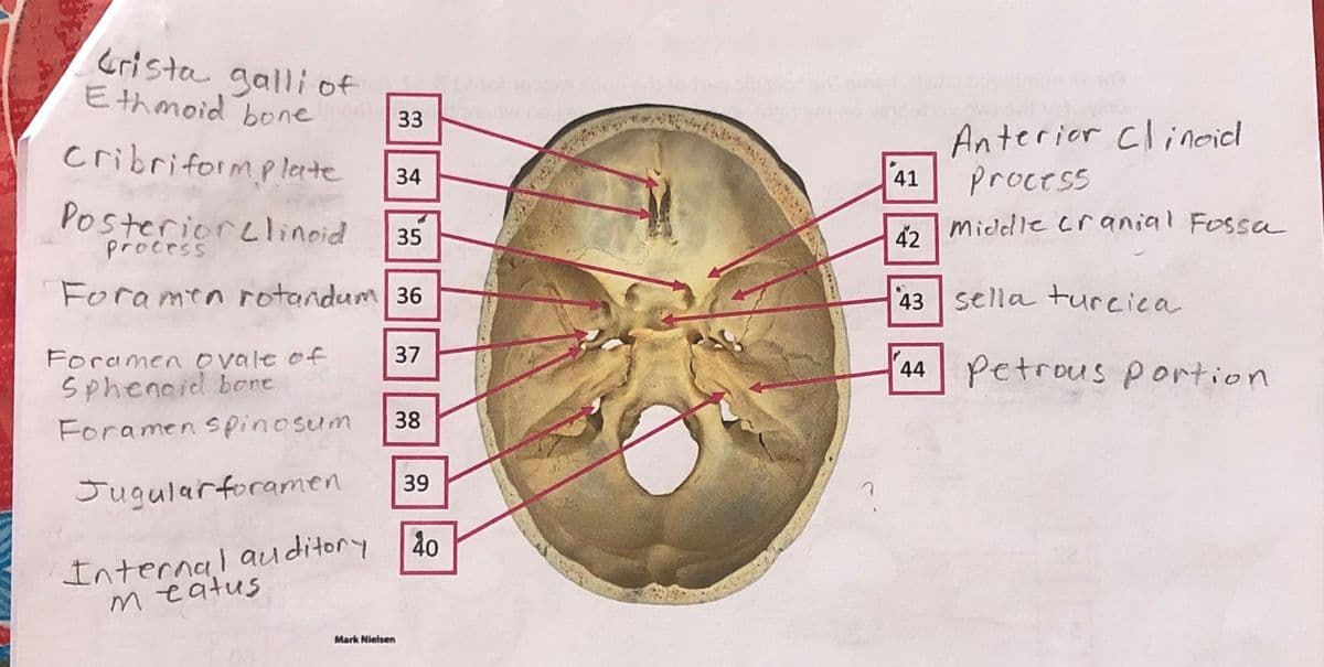 Crista galliof -
Ethmoid bone
33
Anterior Clineidl
process
cribriformp lerte
34
41
Posteriorclinoid
process
midelle cranial Fossa
42
35
Foramen rotandum 36
43 sella turcica
Foramen o vale of
Sphenoid bcre
37
44 Petrous portion
38
Foramen spinosum
39
Jugularforamen
Internal auditory
meatus
40
Mark Nieisen
