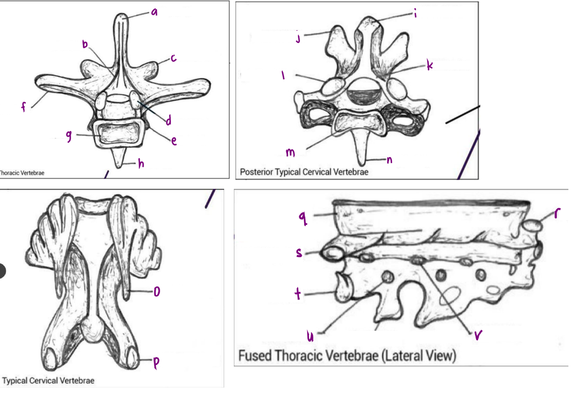 a
b.
f
m
Thoracic Vertebrae
u.
Posterior Typical Cervical Vertebrae
d.
Fused Thoracic Vertebrae (Lateral View)
Typical Cervical Vertebrae
