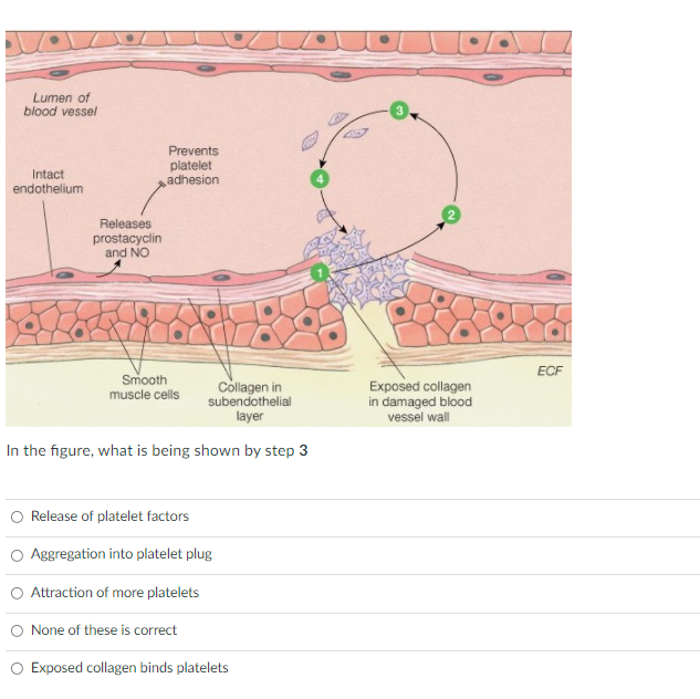 Lumen of
blood vessel
Prevents
Intact
endothelium
platelet
adhesion
Releases
prostacyclin
and NO
ECF
Smooth
Collagen in
subendothelial
layer
Exposed collagen
in damaged blood
vessel wall
muscle cells
In the figure, what is being shown by step 3
Release of platelet factors
Aggregation into platelet plug
O Attraction of more platelets
O None of these is correct
O Exposed collagen binds platelets
