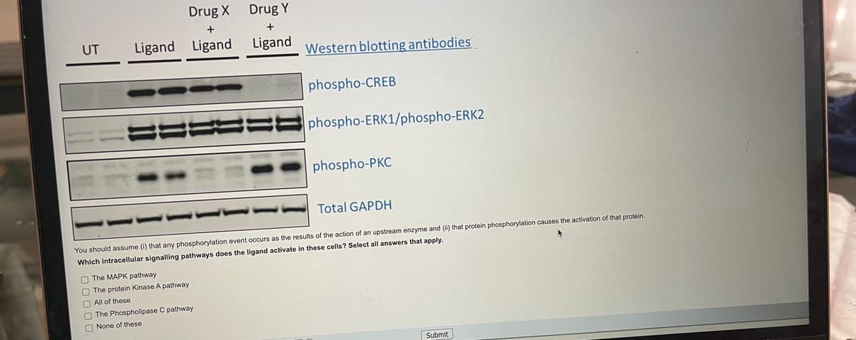 Drug X
Drug Y
UT
Ligand Ligand
Ligand
Western blotting antibodies
phospho-CREB
phospho-ERK1/phospho-ERK2
phospho-PKC
Total GAPDH
You should assume (i) that any phosphorylation event occurs as the results of the action of an upstream enzyme and (ii) that protein phosphorylation causes the activation of that protein.
Which intracellular signalling pathways does the ligand activate in these cells? Select all answers that apply.
The MAPK pathway
The protein Kinase A pathway
All of these
The Phospholipase C pathway
None of these
Submit
