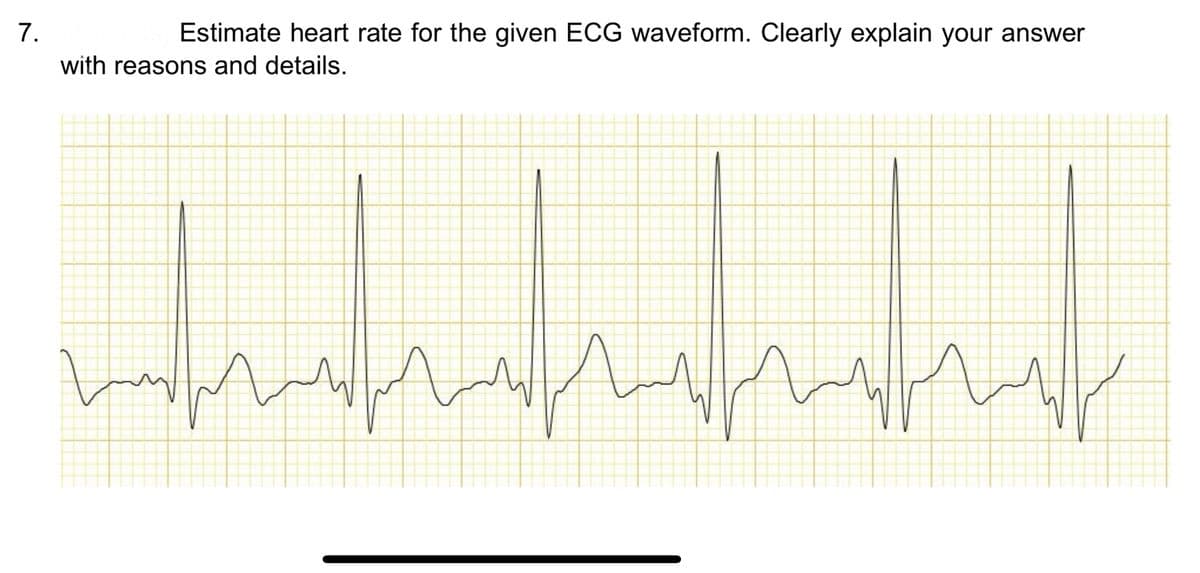 7.
Estimate heart rate for the given ECG waveform. Clearly explain your answer
with reasons and details.
