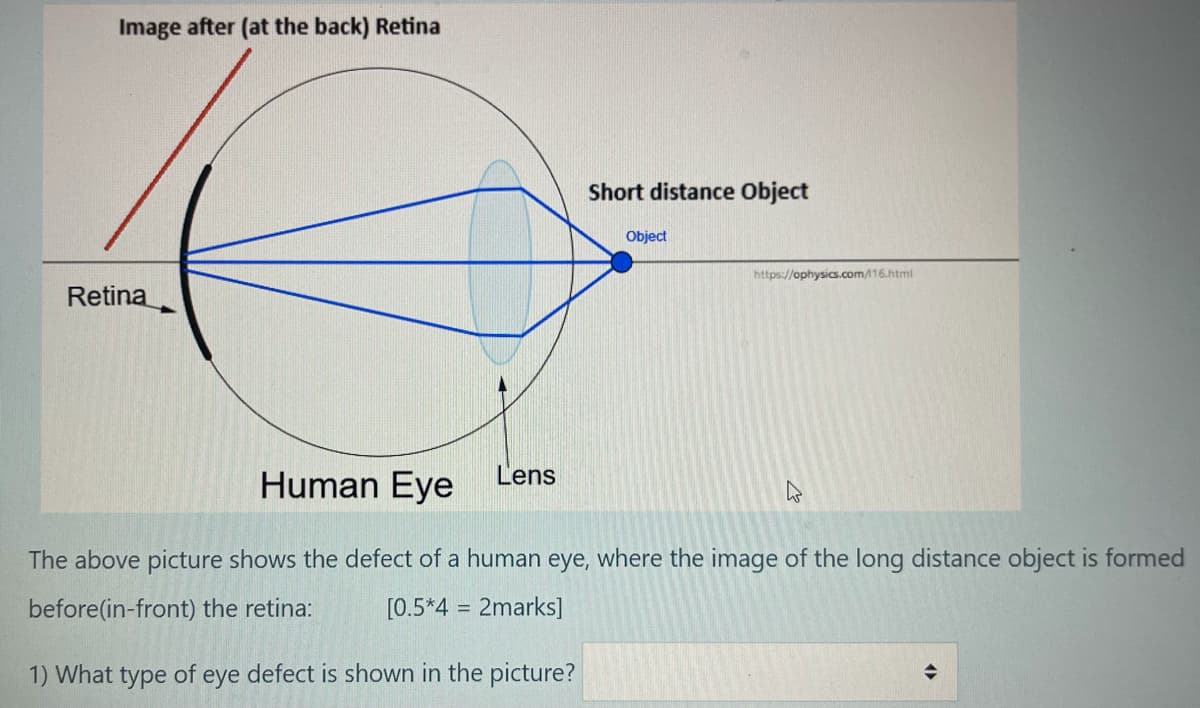 Image after (at the back) Retina
Short distance Object
Object
https://ophysic.com/16.html
Retina
Human Eye
Lens
The above picture shows the defect of a human eye, where the image of the long distance object is formed
before(in-front) the retina:
[0.5*4 = 2marks]
%3D
1) What type of eye defect is shown in the picture?
