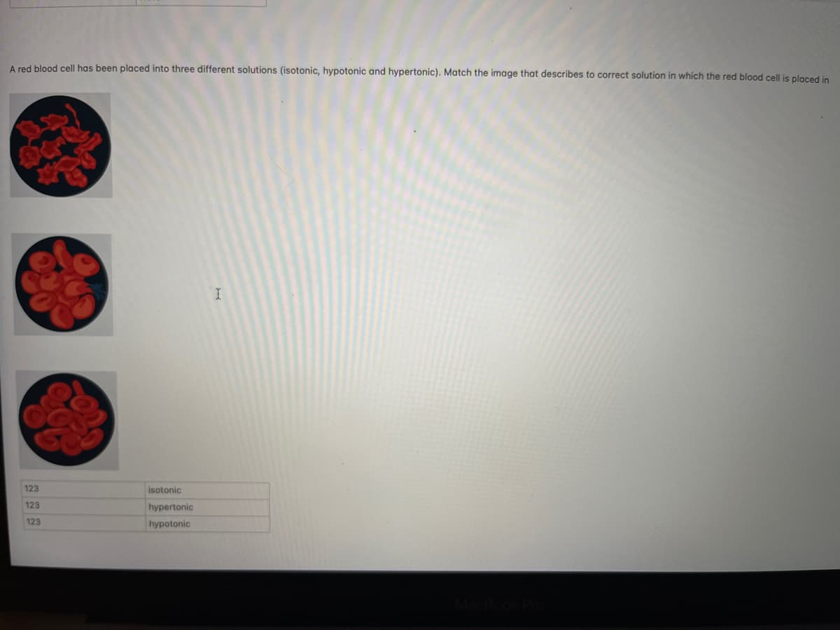 A red blood cell has been placed into three different solutions (isotonic, hypotonic and hypertonic). Match the image that describes to correct solution in which the red blood cell is placed in
123
123
123
isotonic
hypertonic
hypotonic
I
