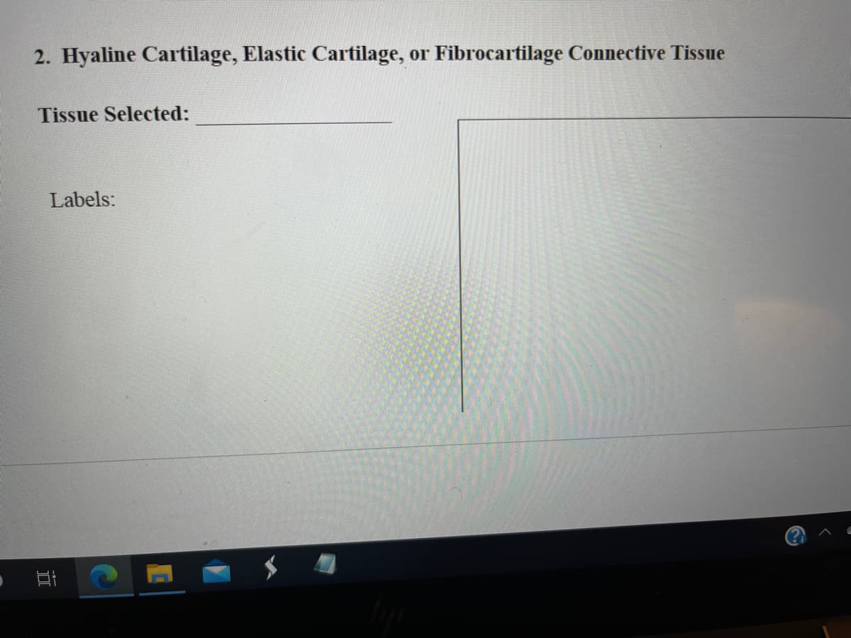 2. Hyaline Cartilage, Elastic Cartilage, or Fibrocartilage Connective Tissue
Tissue Selected:
Labels:
立
