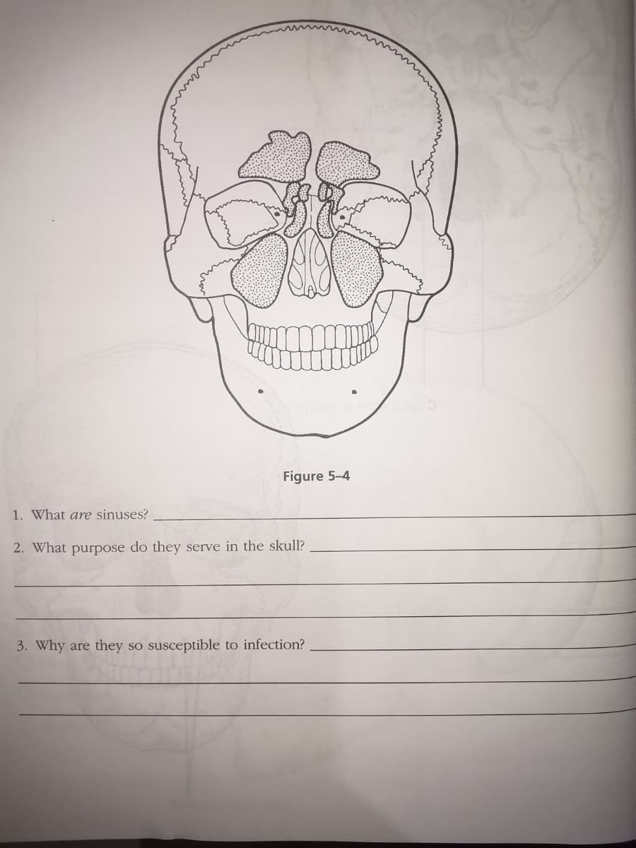 Figure 5-4
1. What are sinuses?
2. What purpose do they serve in the skull?
3. Why are they so susceptible to infection?
