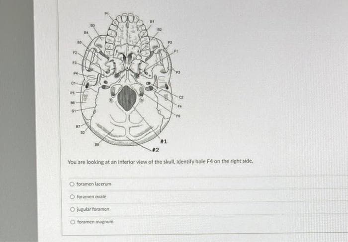 $3
P4.
C1
PS
DO
#2
O foramen lacerum
O foramen ovale
O jugular foramen
foramen magnum
#1
You are looking at an inferior view of the skull, Identify hole F4 on the right side.