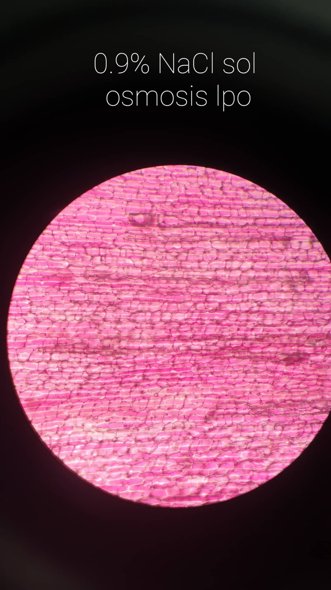 0.9% NaCl sol
osmosis Ipo