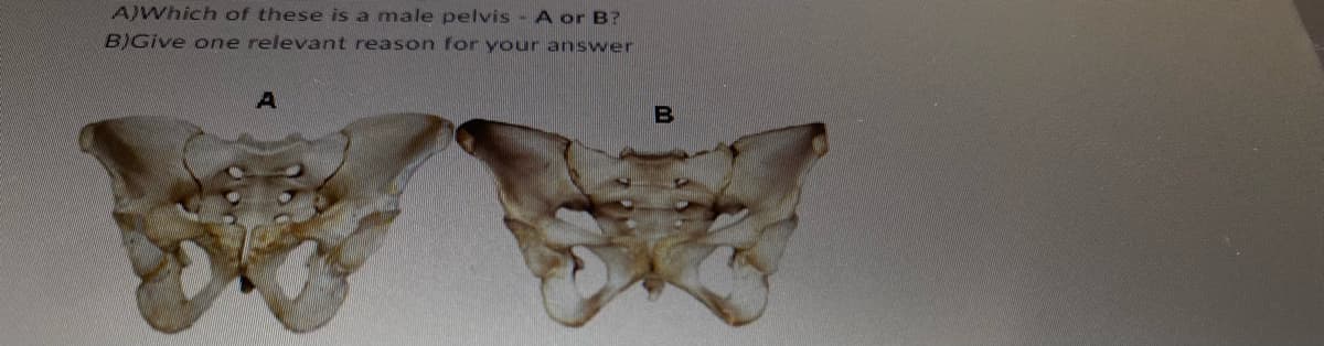 A)Which of these is a male pelvis - A or B?
B)Give one relevant reason for your answer
A