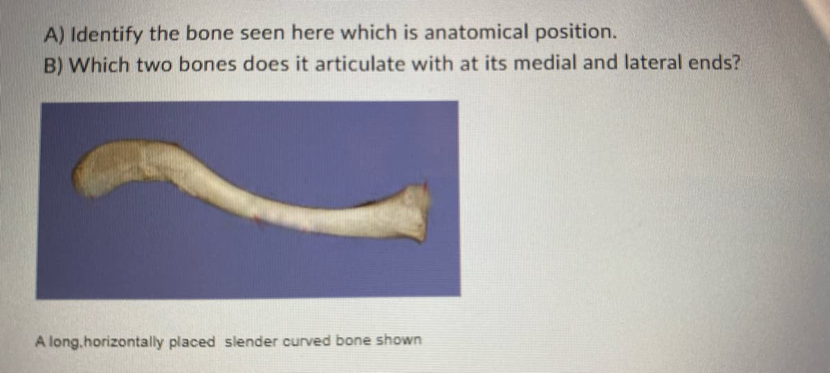 ### Anatomy Educational Resource

---

**Question A:** Identify the bone seen here which is in anatomical position.

**Question B:** Which two bones does it articulate with at its medial and lateral ends?

**Description of Image:**
The image shows a horizontally placed, slender curved bone on a purple background.

---

**Explanation:**
The bone displayed in the image is long, horizontally placed, and curved, typically indicative of a clavicle. 

### Anatomical Position and Articulations of the Clavicle
- **Medial End**: The clavicle articulates with the sternum (specifically the manubrium) at the sternoclavicular joint.
- **Lateral End**: The clavicle articulates with the scapula (acromion) at the acromioclavicular joint.

By understanding these connections, one gains insight into the role of the clavicle in providing structural support and facilitating a wide range of shoulder movements.

---

This section is designed to aid in the learning and identification of anatomical structures and their relationships, contributing to a comprehensive understanding of human anatomy.

**Important Note for Students:**
Pay attention to the shape and positioning of the bones while studying skeletal anatomy as it greatly aids in identification and understanding of their functional roles and articulations within the human body.