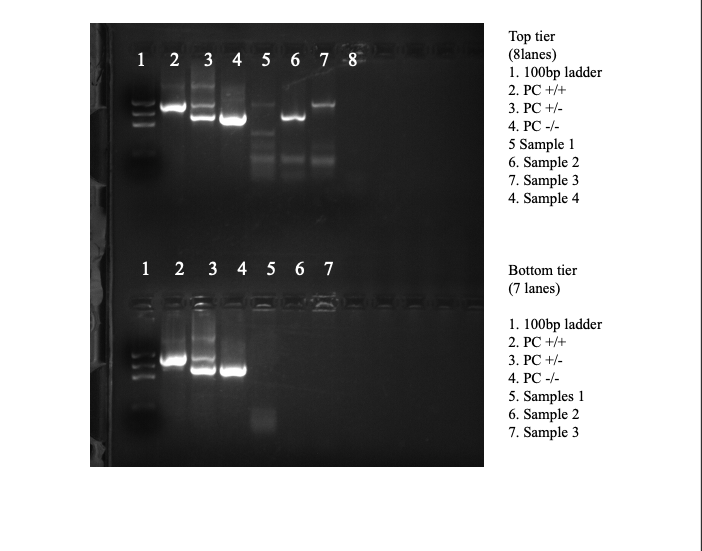Top tier
(8lanes)
1. 100bp ladder
2. PC +/+
1 2 3 4 5 6 7 8
3. РС +/-
4. РC -/-
Sample 1
6. Sample 2
7. Sample 3
4. Sample 4
1 2 3 4 5 6 7
Bottom tier
(7 lanes)
1. 100bp ladder
2. РС +/+
3. РС +/-
4. РC -/-
5. Samples 1
6. Sample 2
7. Sample 3
