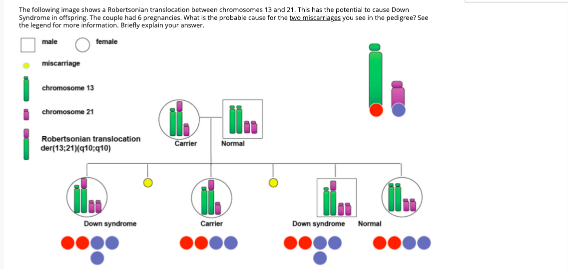 The following image shows a Robertsonian translocation between chromosomes 13 and 21. This has the potential to cause Down
Syndrome in offspring. The couple had 6 pregnancies. What is the probable cause for the two miscarriages you see in the pedigree? See
the legend for more information. Briefly explain your answer.
male
female
miscarriage
chromosome 13
chromosome 21
Robertsonian translocation
Carrier
Normal
der(13;21)(q10;q10)
Down syndrome
Carrier
Down syndrome
Normal
O DO
